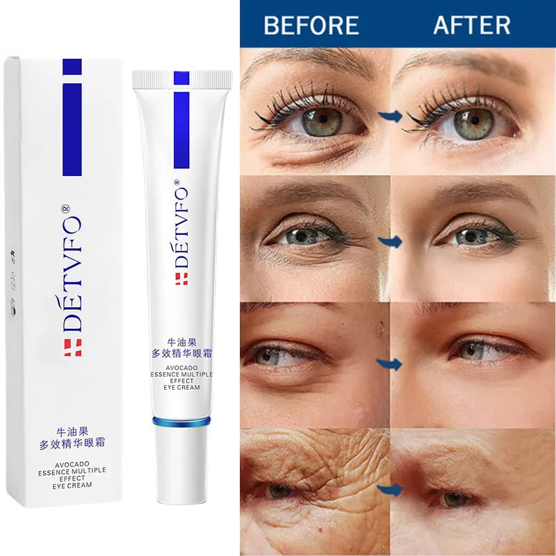 Eye Cream Instant Anti Aging Remove Dark Circles Wrinkle Removal Bags Puffiness Fade Eye Fine Line Skin Face Tighten Korean Care