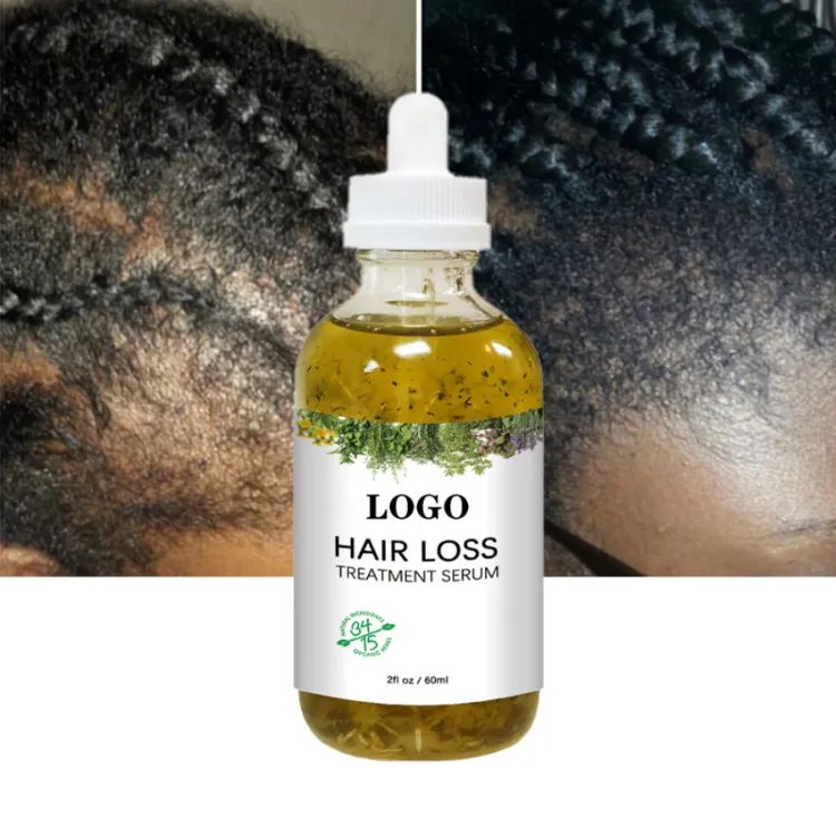 OEM 60ml Fast Hair Regrowth Serum Black Seed Castor Hair Growth Serum Oil Thick Hair Fast Growth For Black Women