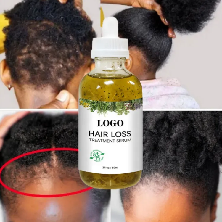 OEM 60ml Fast Hair Regrowth Serum Black Seed Castor Hair Growth Serum Oil Thick Hair Fast Growth For Black Women