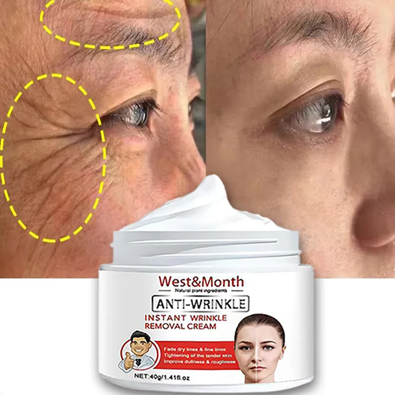 OEM Remove Wrinkle Anti-Aging Fade Fine Lines Face Whitening Brighten Skin Beauty Health Care Retinol Lifting Firming Cream New
