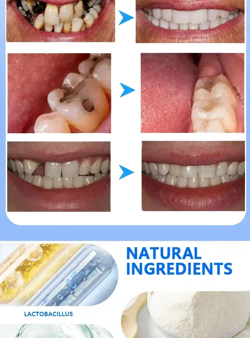 Teeth whitening  fresh bad breath  remove plaque toothache relieve