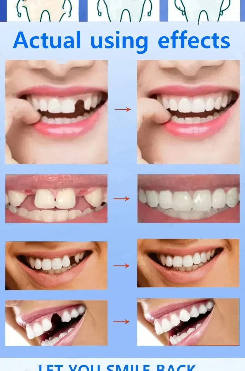 Teeth whitening  fresh bad breath  remove plaque toothache relieve