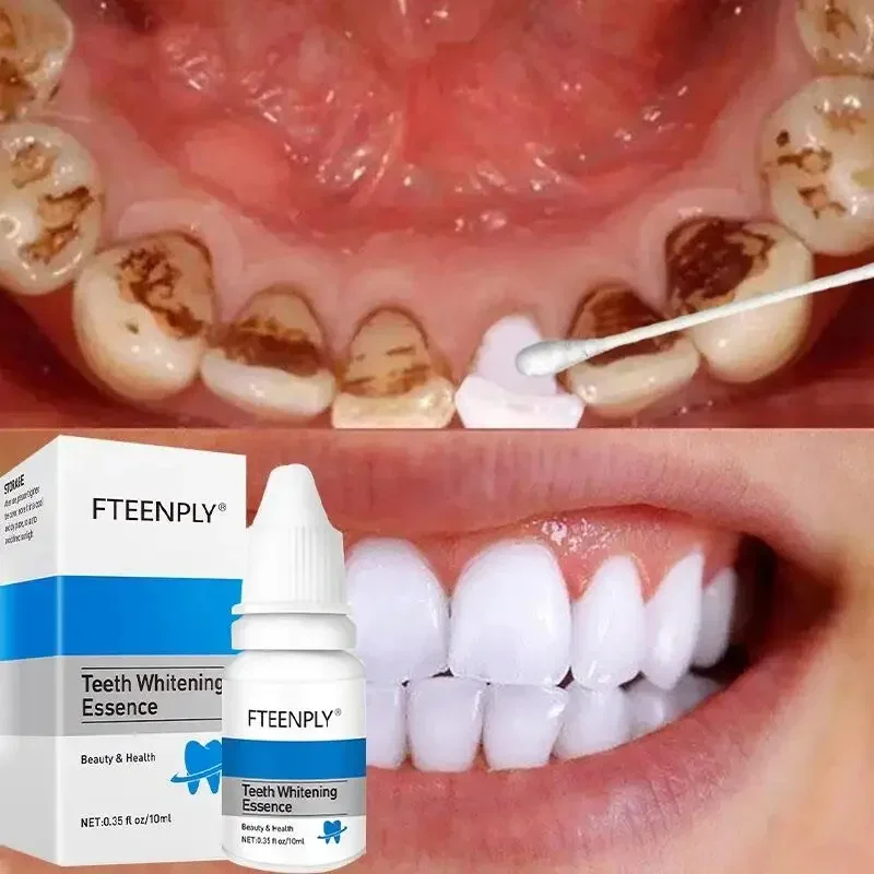 5 Days Teeth Whitening Toothpaste Remove Plaque Stains Powder Deep Cleaning Oral Hygiene Fresh Breath Brightening Tooth Care 50g