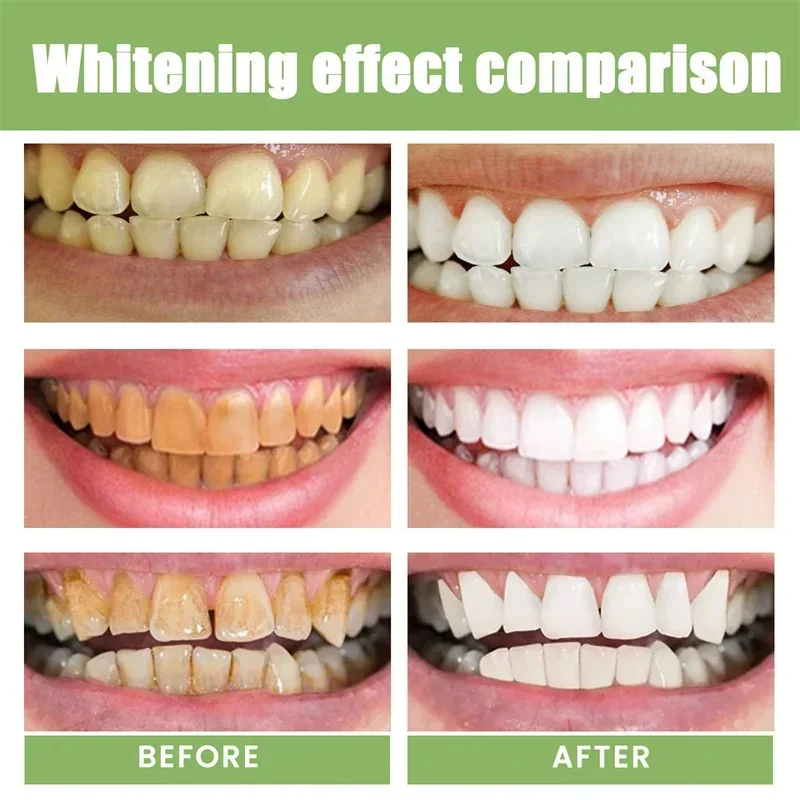 5 Days Teeth Whitening Toothpaste Remove Plaque Stains Powder Deep Cleaning Oral Hygiene Fresh Breath Brightening Tooth Care 50g